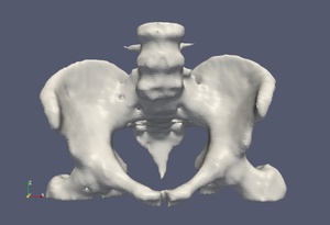 Surface Meshes Smoothing