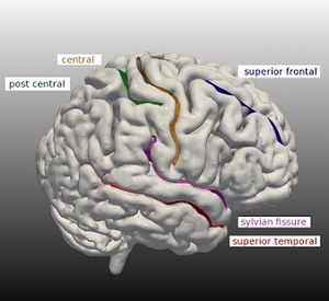 The Labeling of Cortical Sulci using Multidimensional Scaling