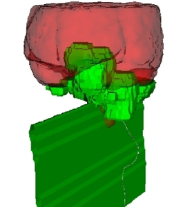 Fully automated segmentation of carotid and vertebral arteries from CTA