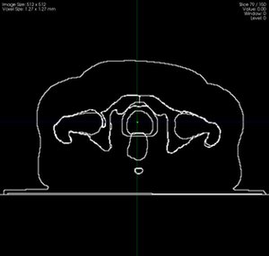 Importing Contours from DICOM-RT Structure Sets