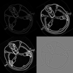 Using the strategy pattern to simplify ITK