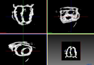 Multi-scale Steerable Phase-Symmetry Filters for ITK