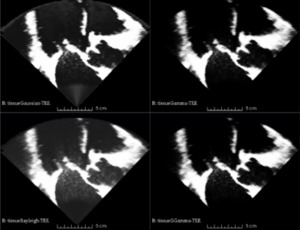 Probabilistic Tissue Characterization for Ultrasound Images