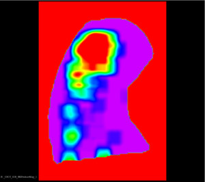 Computing Bone Morphometric Feature Maps from 3-Dimensional Images